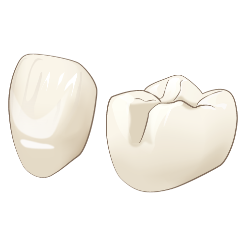 港区 虎ノ門 まさいデンタルクリニック C1　歯の表面（エナメル質）の虫歯